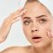 Clogged Pores and Blackheads: Causes and Methods of Struggle
